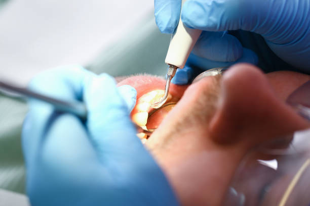 Best Emergency Treatment for Jaw Pain or Injury in Xenia, OH