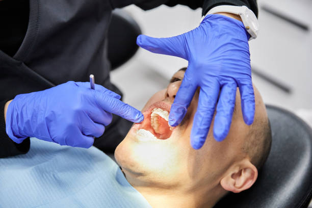 Best Emergency Wisdom Tooth Extraction in Xenia, OH